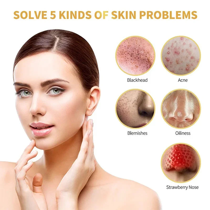 S47c4f4b1496a41a98efa28628c5c4895G